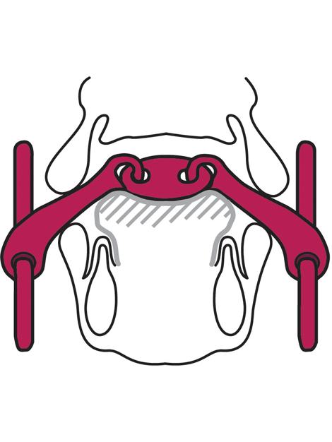 KK Ultra Loose Ring Snaffle 14mm Mouthpiece